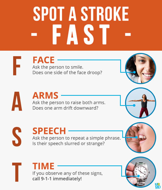 blog-infographic-spot-a-stroke